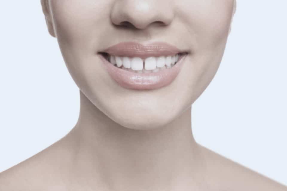 zahnlücken schließen methoden zahnarzt spandau min